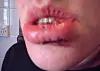 Nathan Hope's busted-lip selfie, the key image from Final Jeopardy! on August 21, 2017.